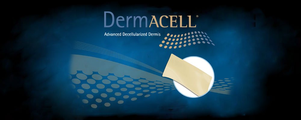 Dermacell - Decellularized dermis 